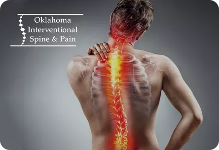 oklahoma spine